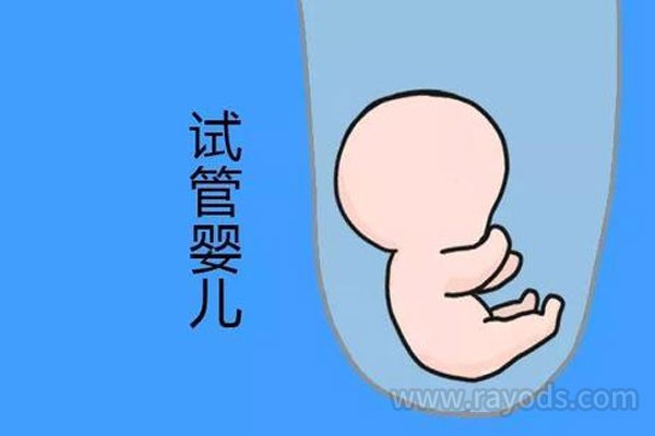 试管婴儿移植后休养生息的要点是什么？