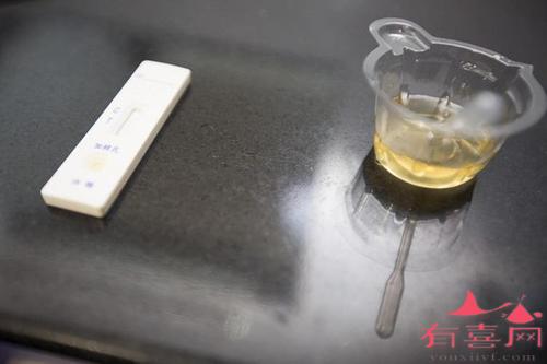 你知道尿液pH值测试的临床意义吗？