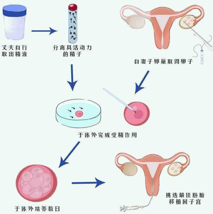 衡阳代怀宝宝花费-在衡阳附件做试管婴儿好吗？