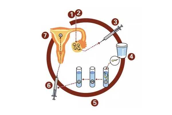 金华捐卵：关于试管婴儿取精，你不知道的事!